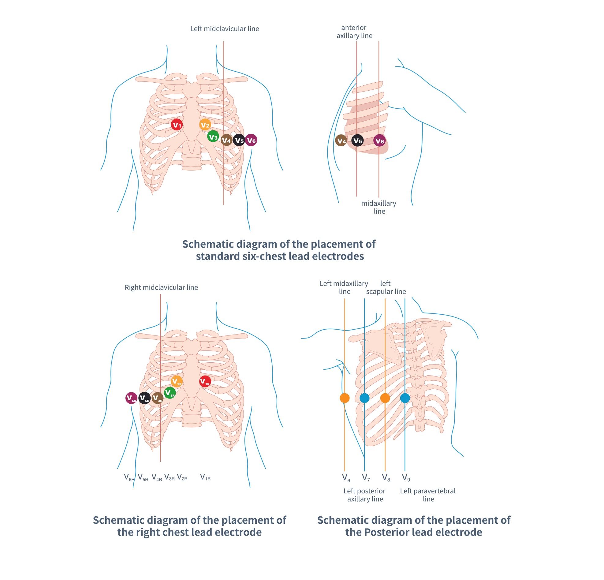 ECG Electrode Placement | Education